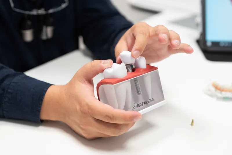 All-on-4: dört implant üzerine sabit köprü modeli